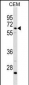 C8B Antibody (C-term)